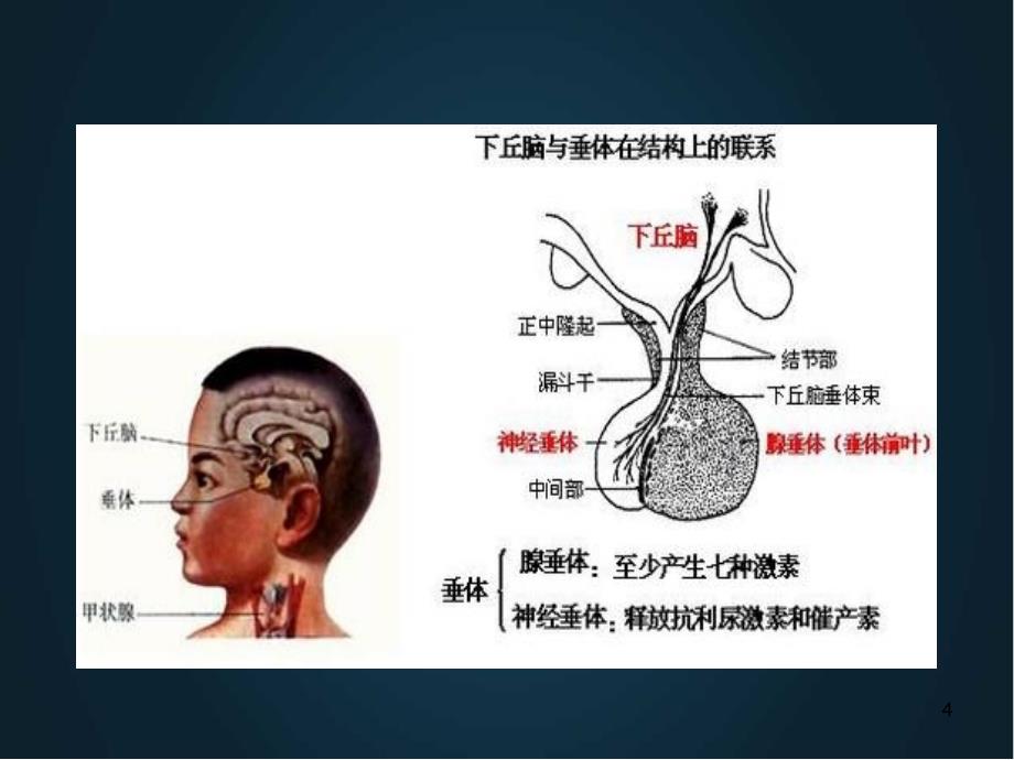 优质课件垂体危象的预防临床表现及治疗_第4页