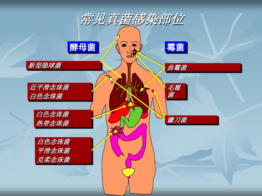 曲霉病的临床研究进展PPT课件_第4页