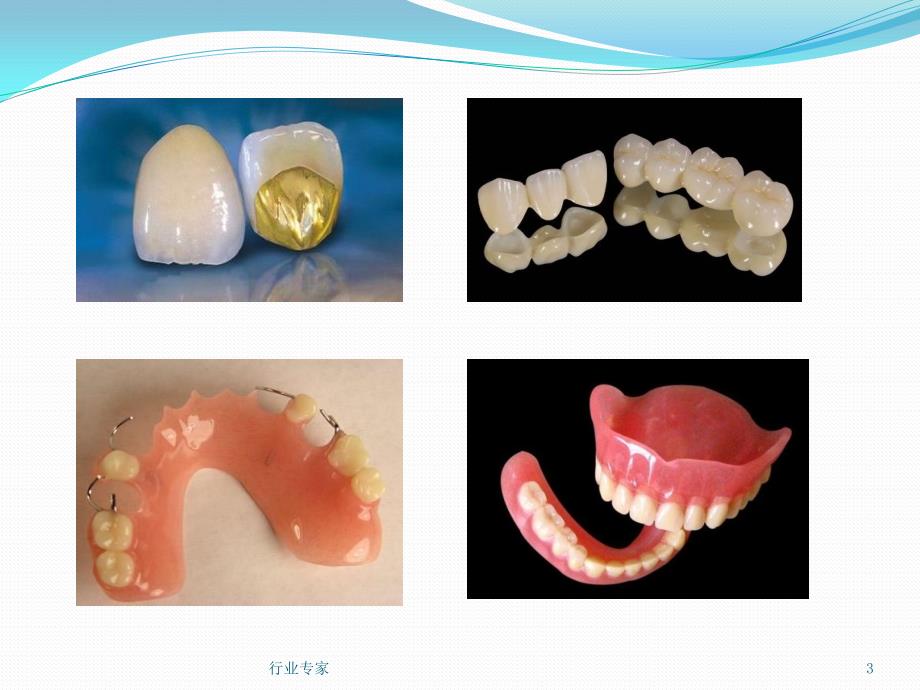 种植义齿概述行业严选_第3页