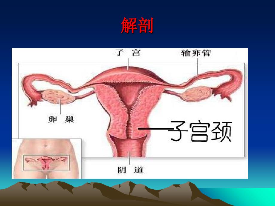 子宫颈癌的护理课件_第4页