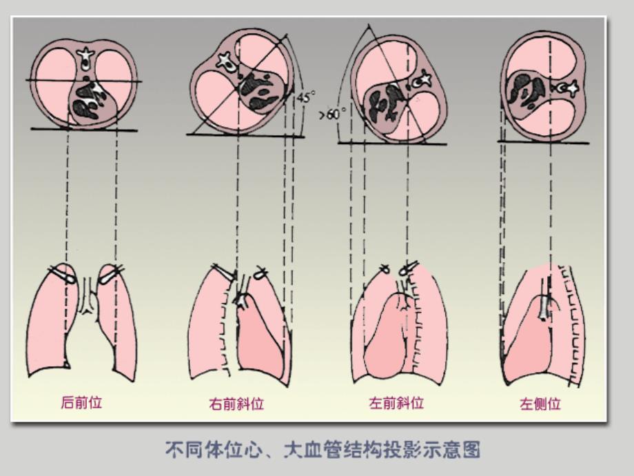 循环系统影像学表现(详细、全面)_第3页