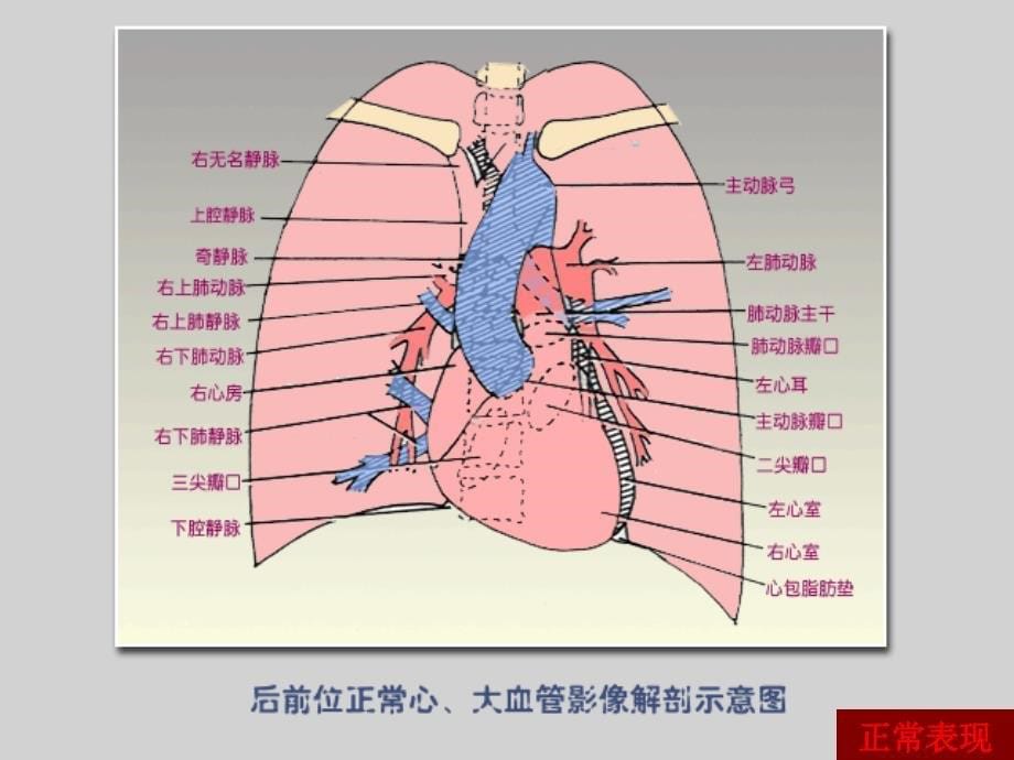 循环系统影像学表现(详细、全面)_第5页