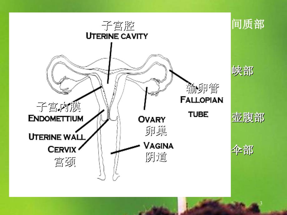 （优质课件）异位妊娠新进展_第3页