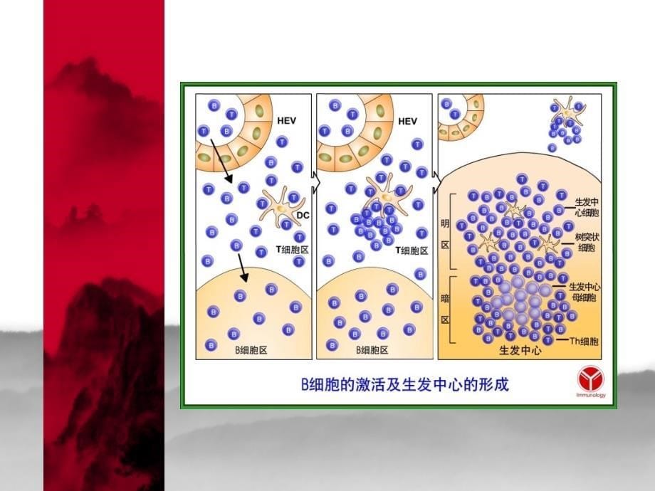 《多发性骨髓瘤》PPT课件_第5页