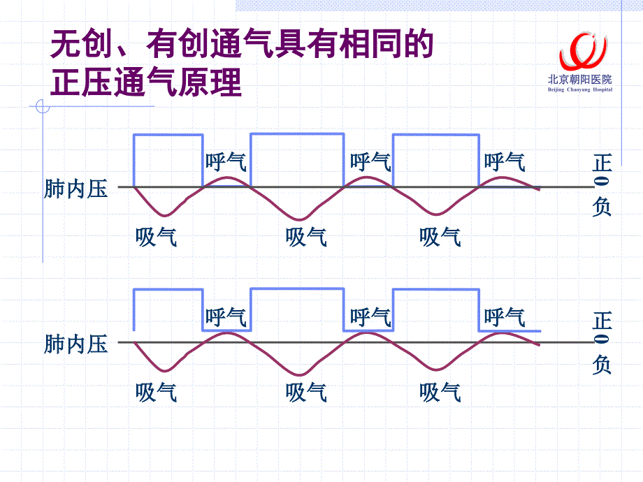 序贯性机械通气曹志新王辰_第3页