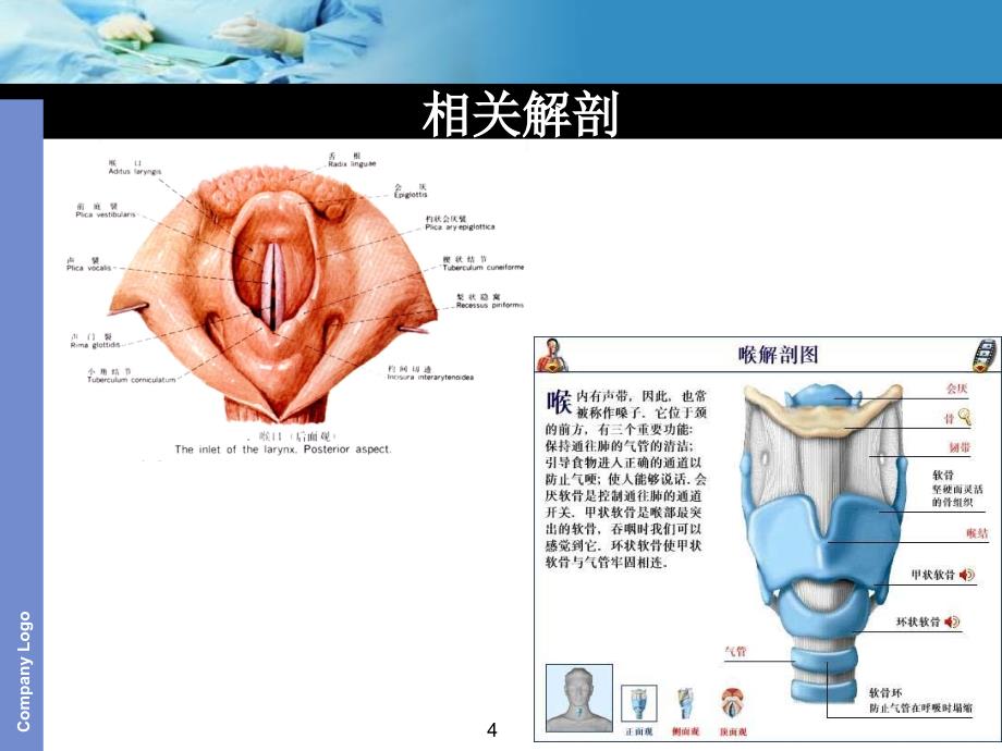 气管插管PPT课件_第4页