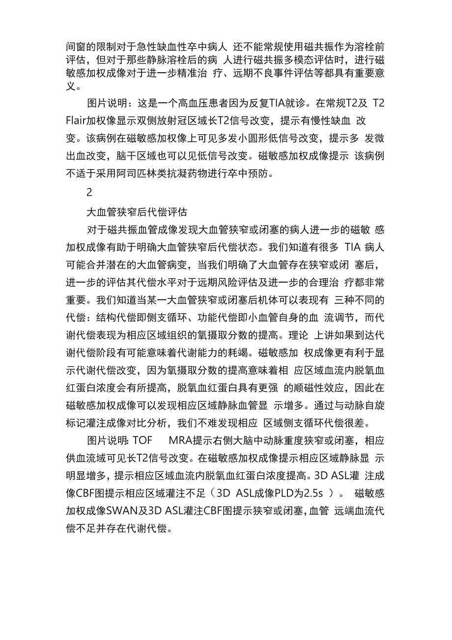 磁敏感加权成像从技术到临床_第2页