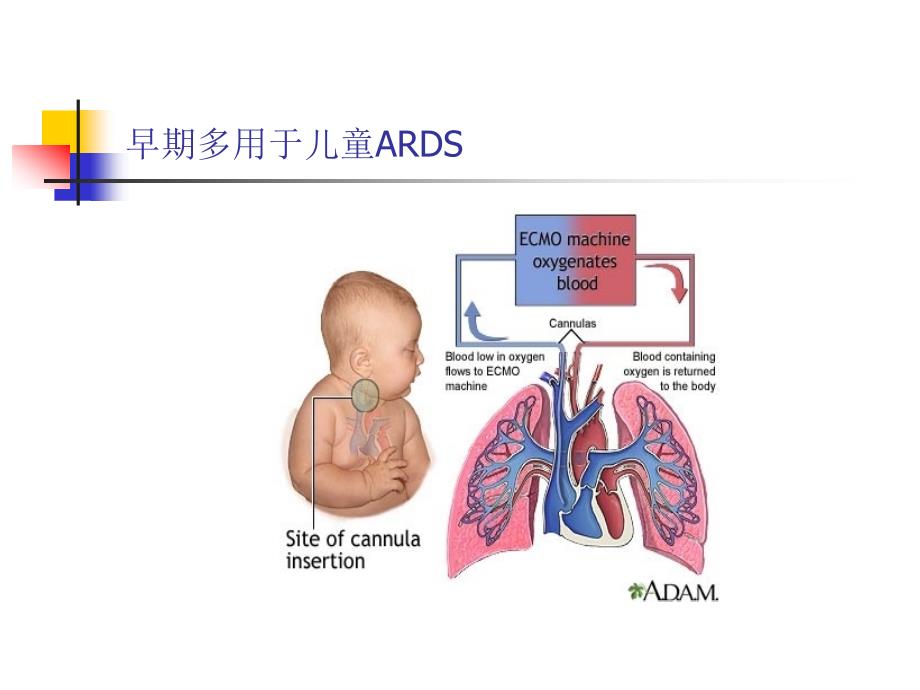 ecmo支持下心脏急危重症救治ppt课件_第4页