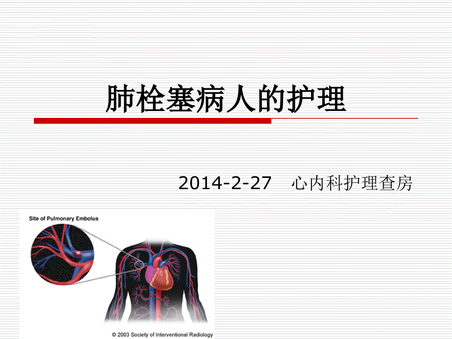 肺栓塞病人的护理查房ppt课件_第1页