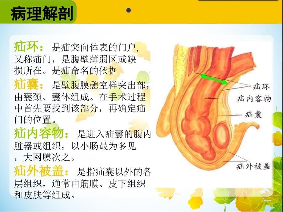 腹股沟疝手术配合_第5页