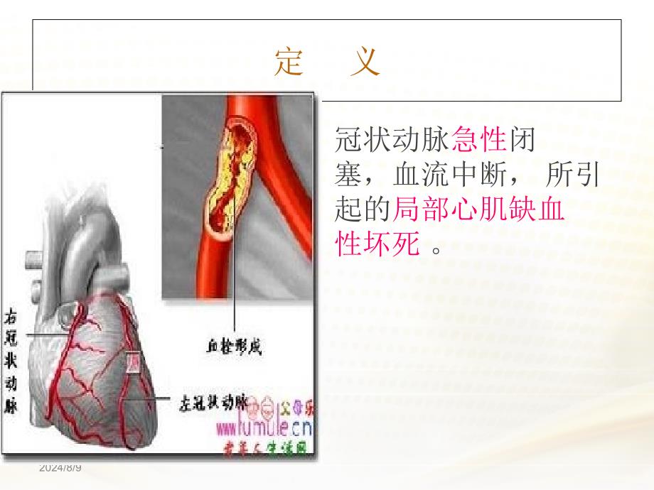 急性心肌梗死的急救护理27组_第3页