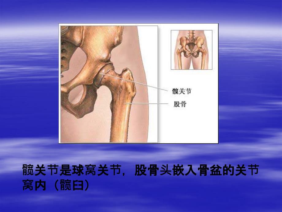 髋关节置换术PPT_第3页