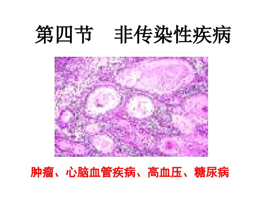 心脑血管疾病2名师编辑PPT课件_第1页