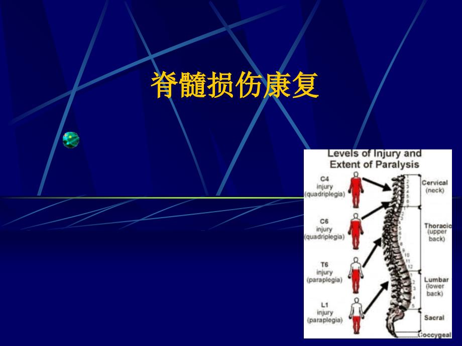 脊髓损伤康复-PPT课件_第1页