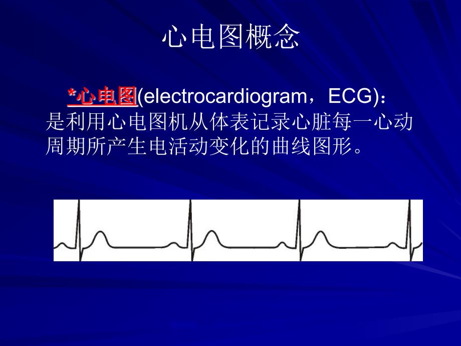 心律失常心电图名师编辑PPT课件_第2页