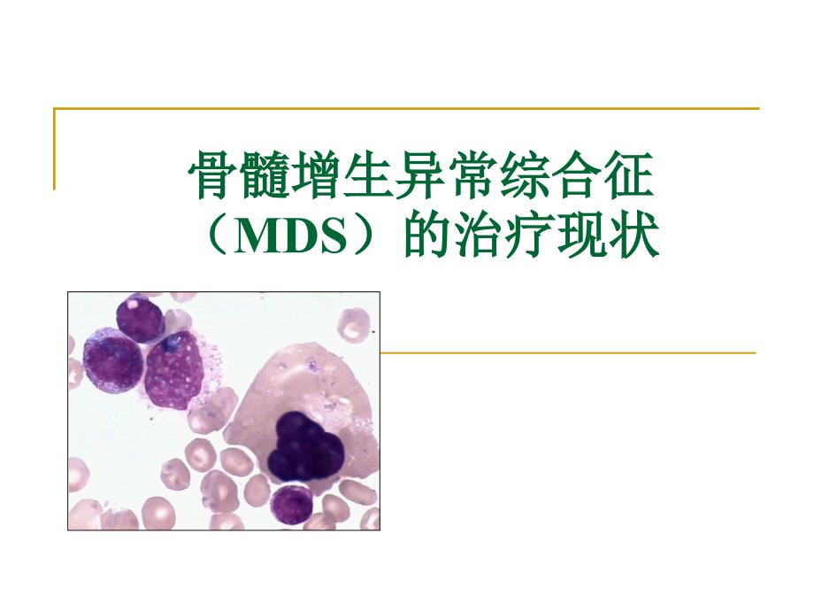 骨髓增生异常综合征MDS的诊疗现状_第1页