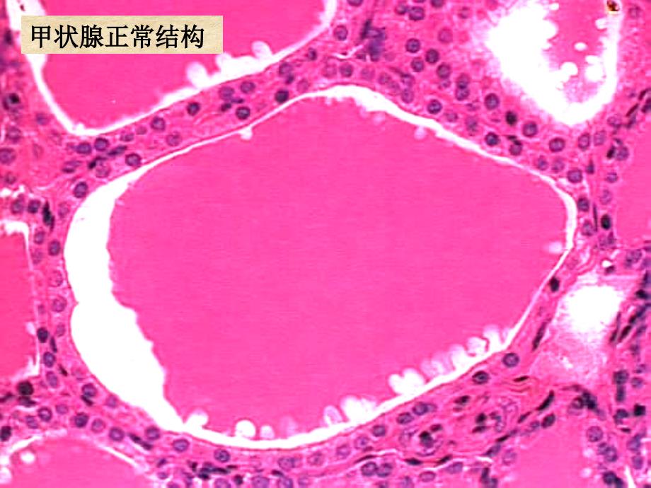 病理学第八版最新课件内分泌系统疾病_第3页