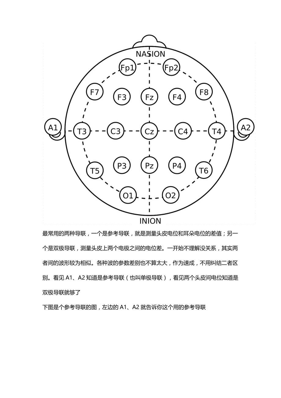 你一定喜欢的脑电图速成_第2页