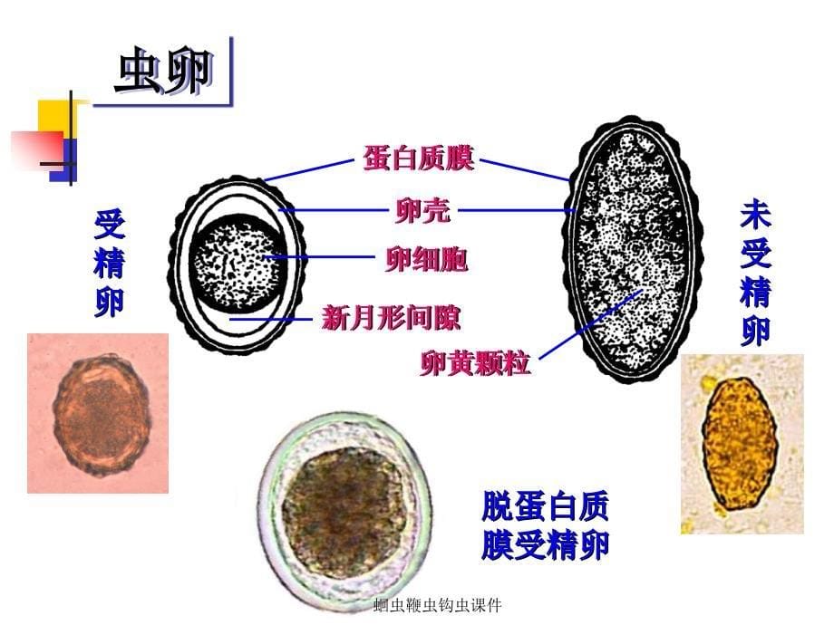 蛔虫鞭虫钩虫课件_第5页