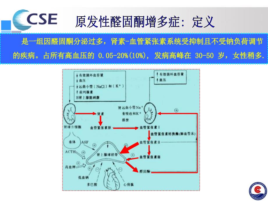 原发性醛固酮增多症诊断进展-王卫庆_第4页