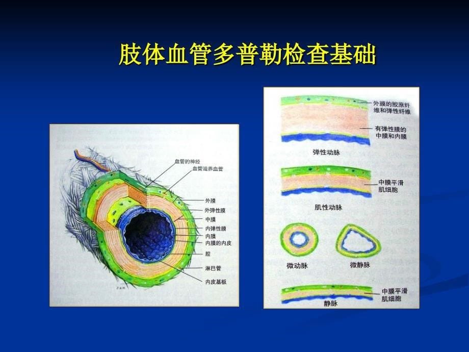 周围血管超声检查课件_第5页