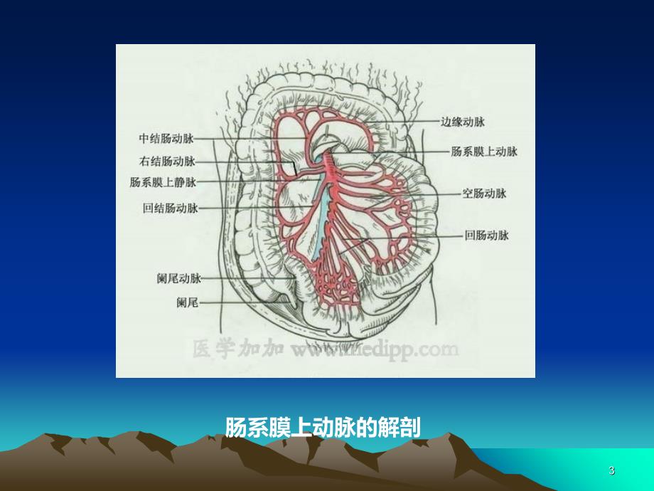 肠系膜上动脉狭窄综合征的治疗_第3页