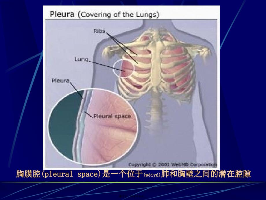 医学专题—胸腔积液(最新修改)_第3页