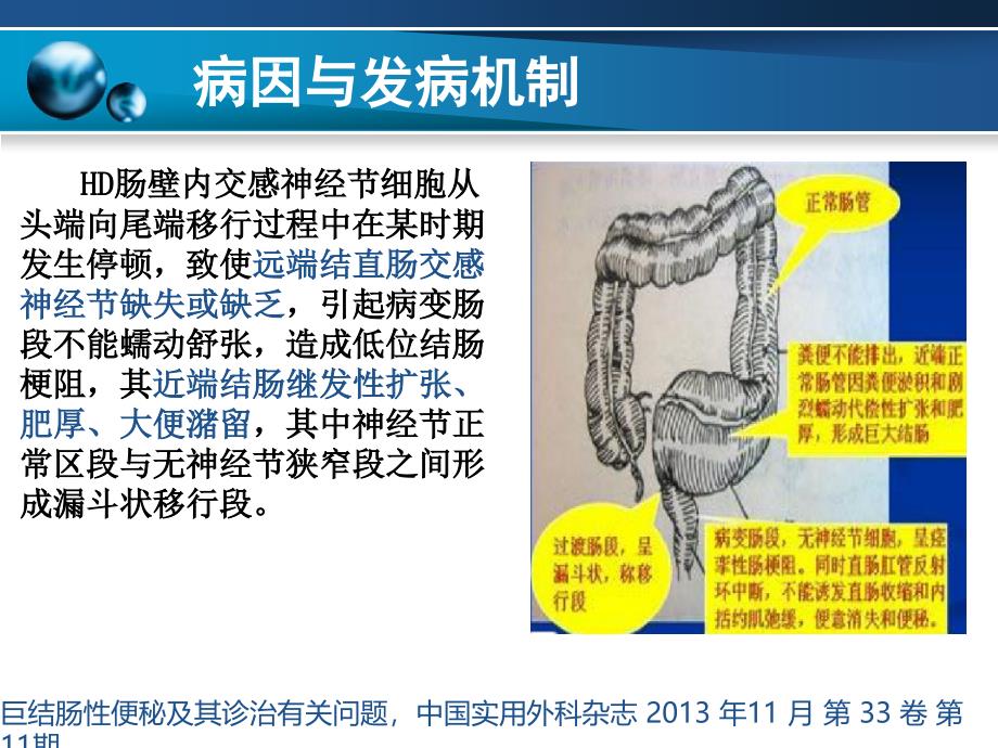 先天性巨结肠修改ppt课件_第3页