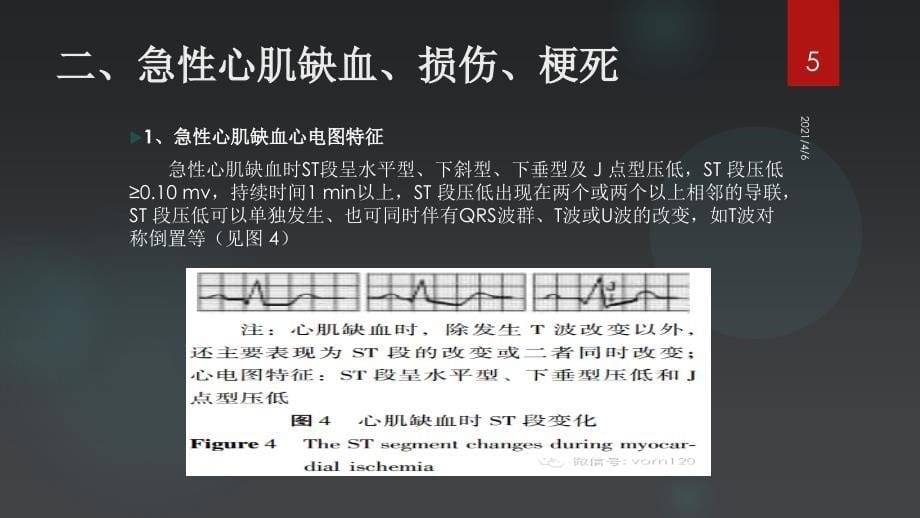 心电图危急值识别文档资料_第5页