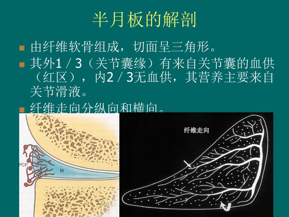 半月板撕裂的MR诊断_第3页