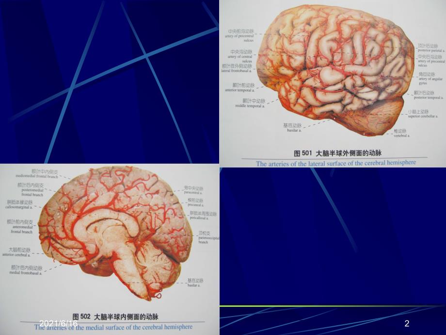 老年痴呆PPT课件_第2页