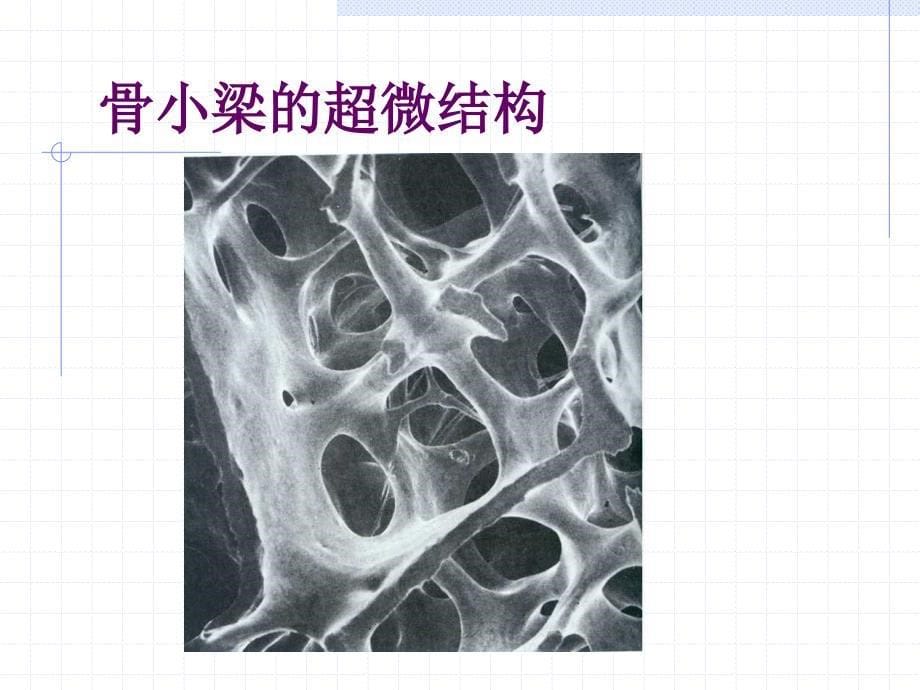 骨质疏松症的康复_第5页