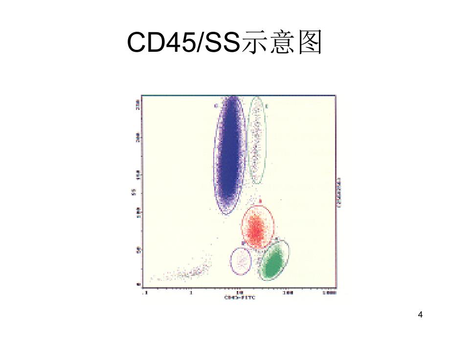 白血病淋巴瘤免疫分型_第4页