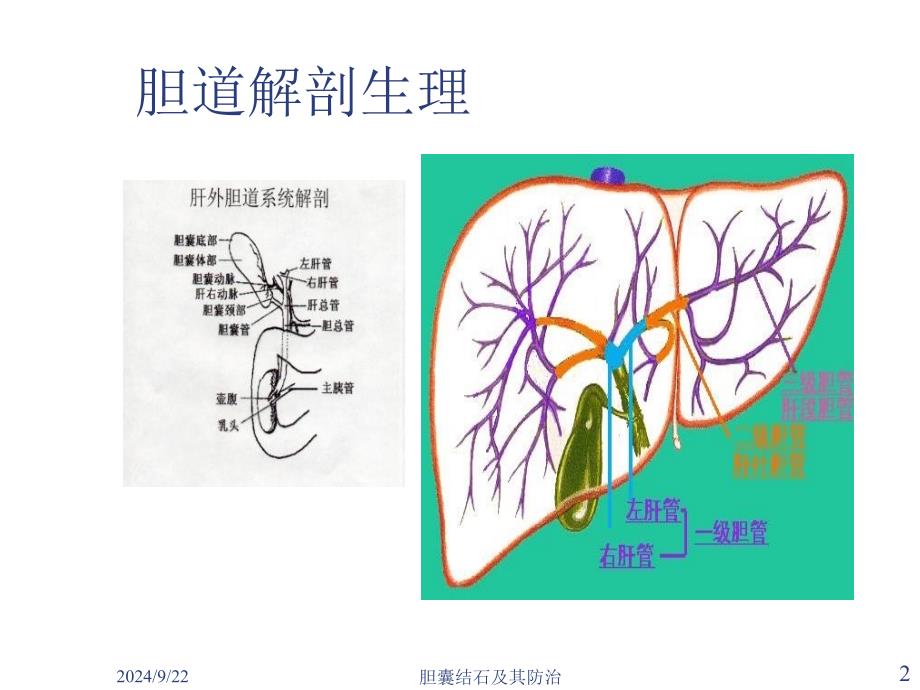 胆囊结石及其防治课件_第2页