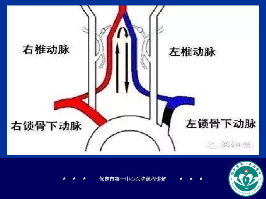 锁骨下静脉立体解剖图_第3页