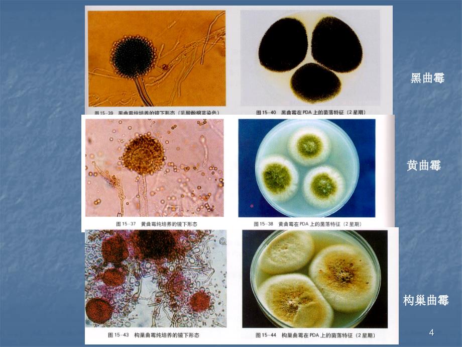 常见霉菌形态观察精选PPT_第4页