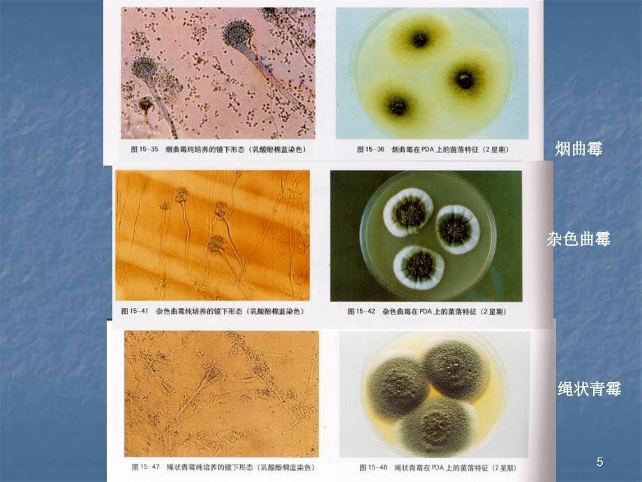 常见霉菌形态观察精选PPT_第5页