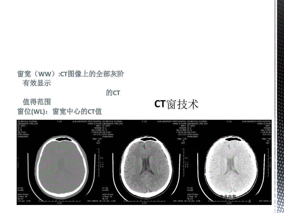 头部CT基础及断面解剖荟萃材料_第3页