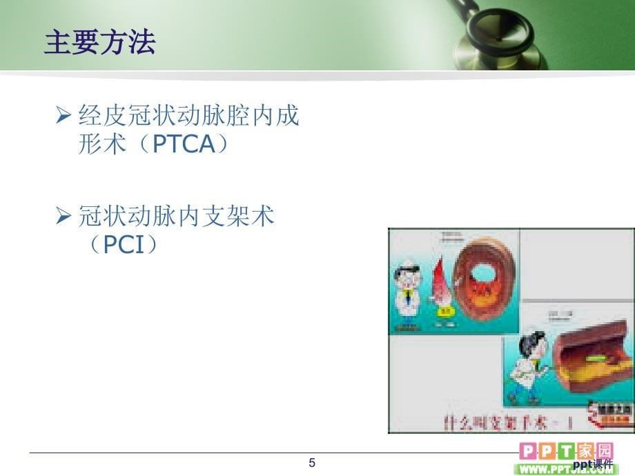 冠心病介入术健康教育ppt课件_第5页