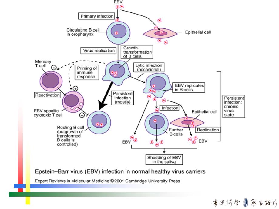 EB病毒感染的特殊表现_第3页