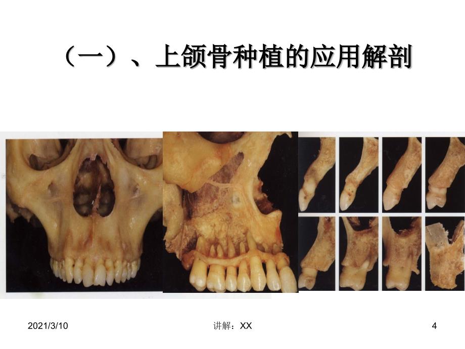 第五章口腔种植的组织解剖学基础参考_第4页