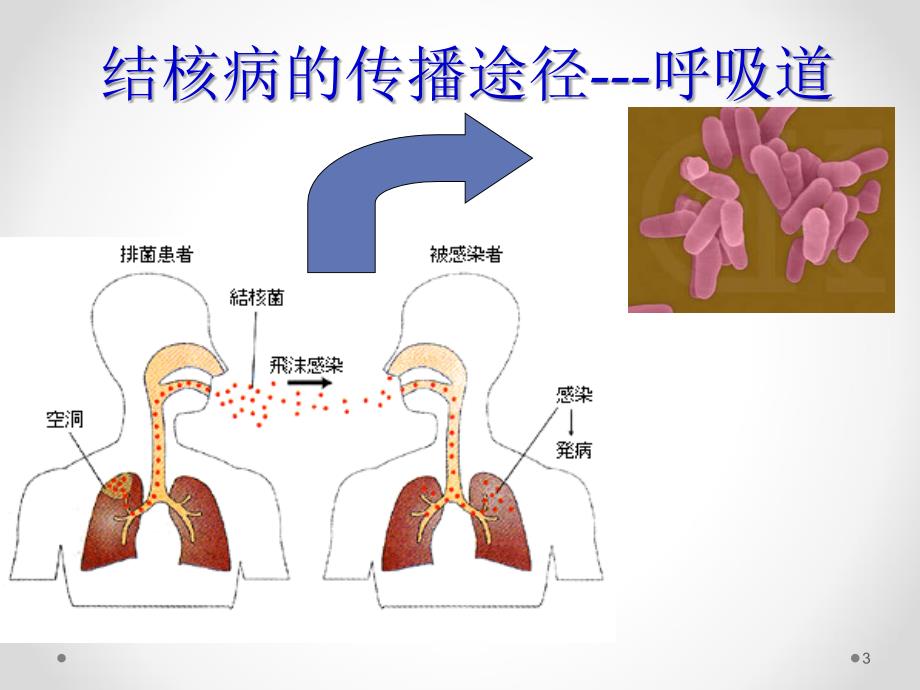 抗结核病药课件_第3页