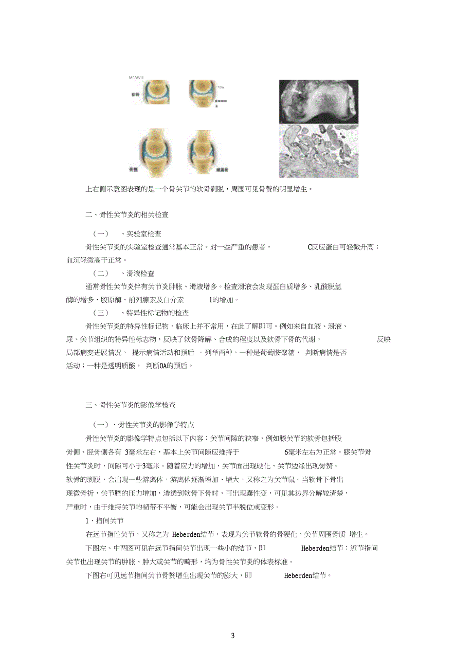 骨关节病的诊断和鉴别诊断_第3页