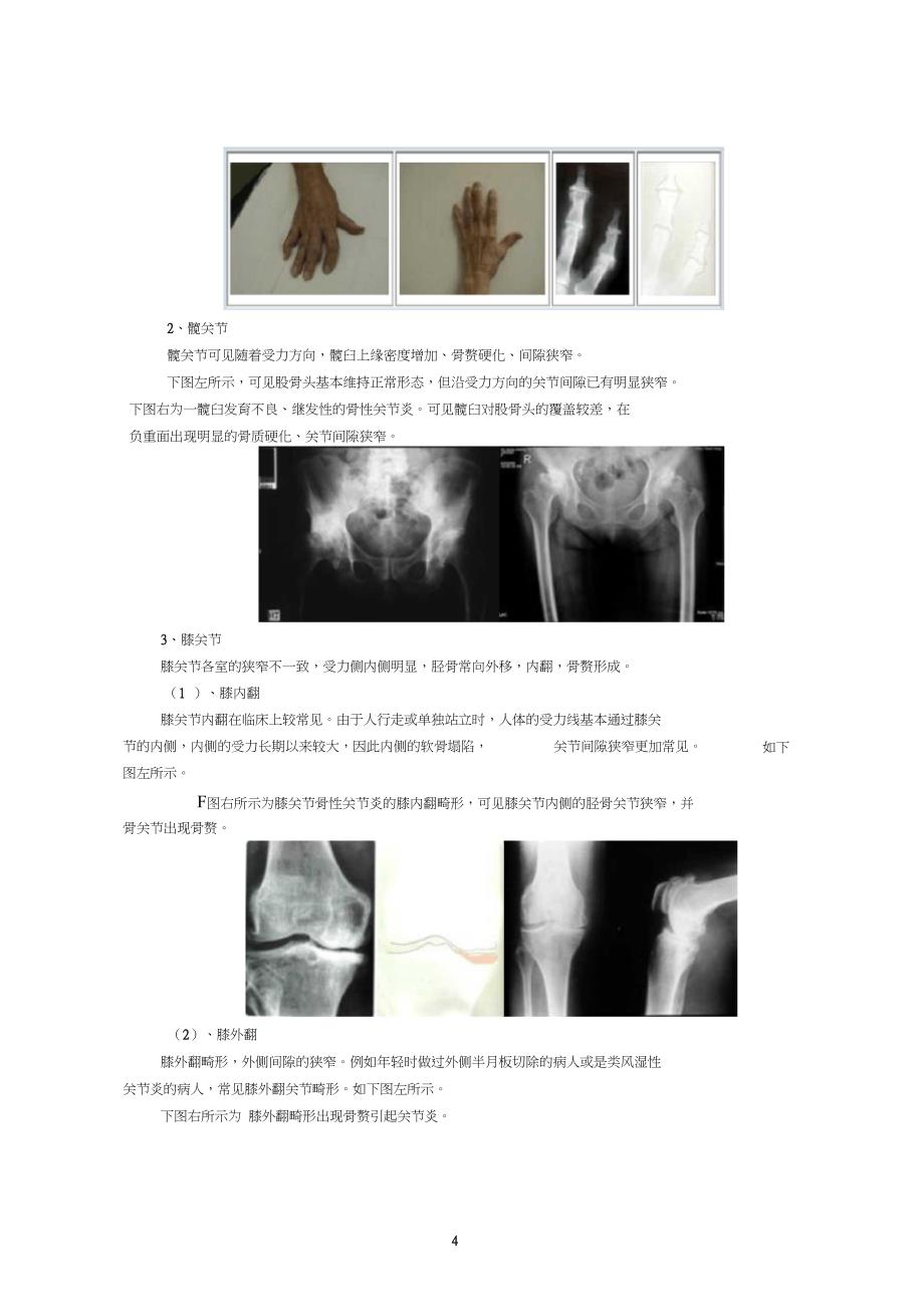 骨关节病的诊断和鉴别诊断_第4页