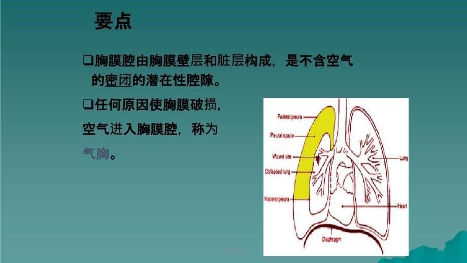 气胸诊治课件_第5页