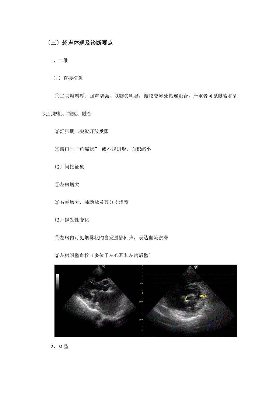 心脏瓣膜病超声_第2页