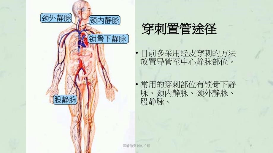 深静脉穿刺的护理课件_第5页