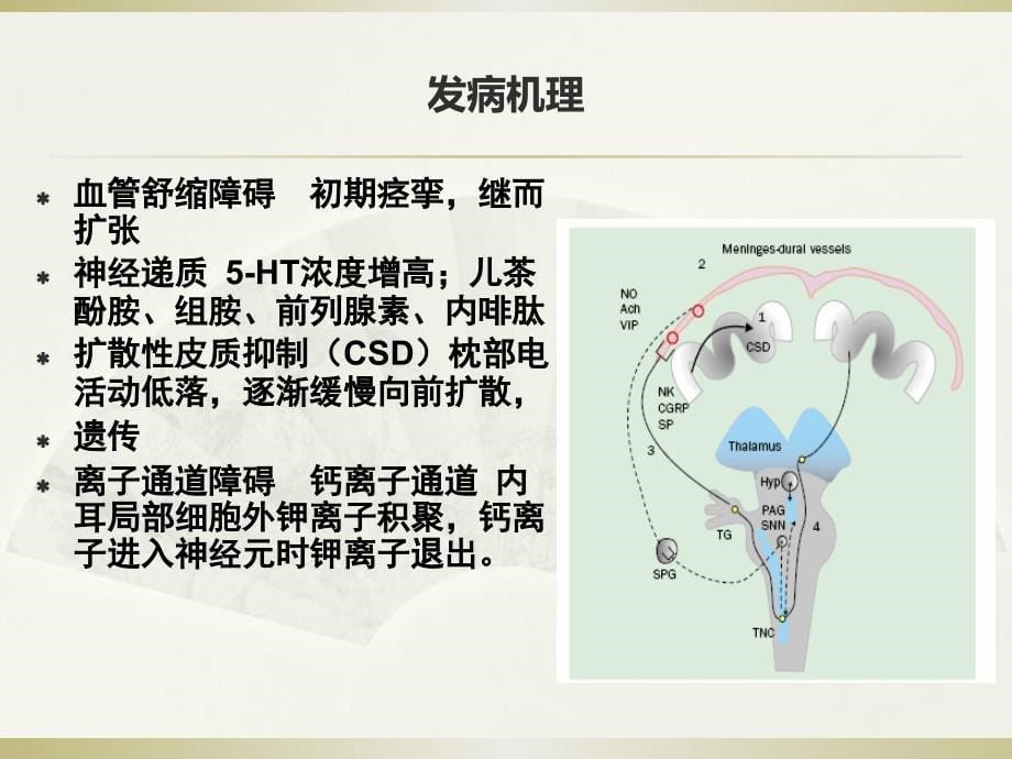 偏头痛诊治-2016博士_第5页