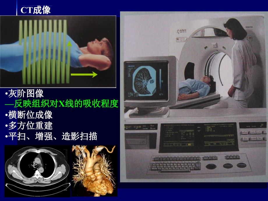 心脏影像学的解剖学基础ppt课件_第3页