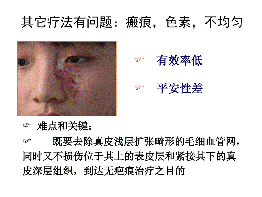 光动力疗法治疗鲜红斑痣_第3页